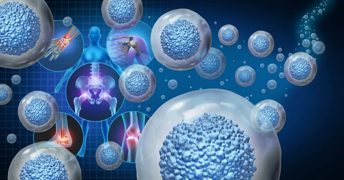 Wharton's Jelly Stem Cell Therapy in Yuba City, Rocklin and Lincoln, CA