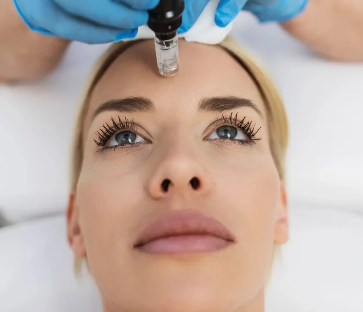 what is prp facial